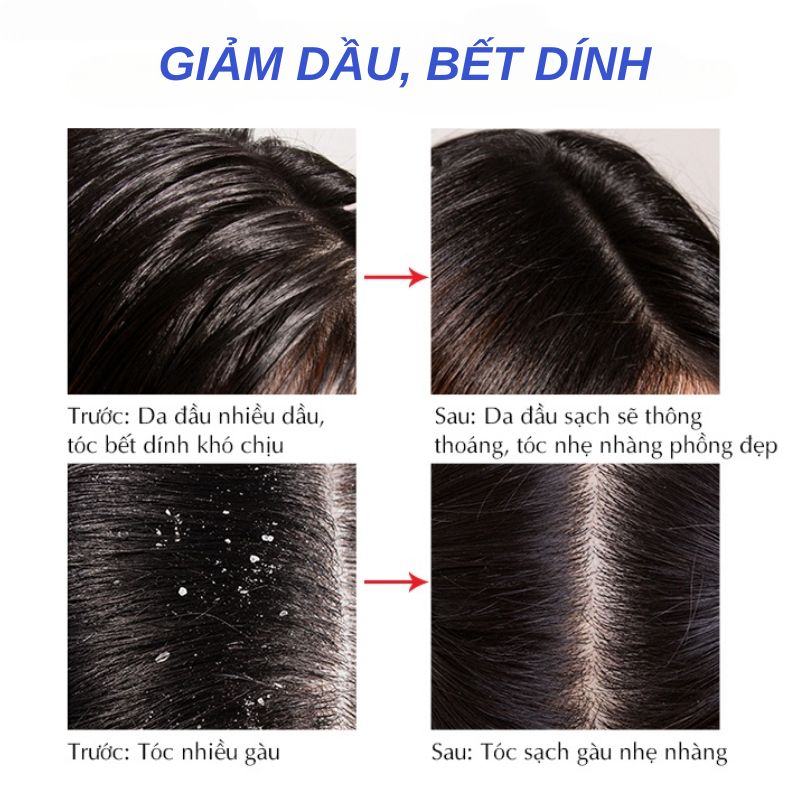 Cặp dầu gội xả Easycos kiềm dầu, giảm rụng, hỗ trợ dày tóc, lưu hương hoa 800ml - Mỹ phẩm divi